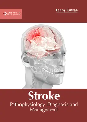 Ictus: Fisiopatología, Diagnóstico y Manejo - Stroke: Pathophysiology, Diagnosis and Management