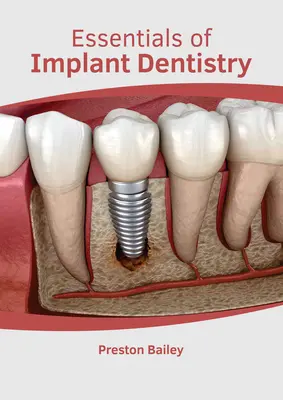 Fundamentos de la implantología - Essentials of Implant Dentistry