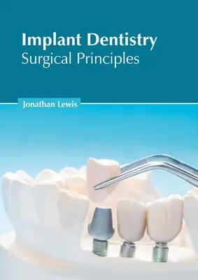 Odontología de implantes: Principios quirúrgicos - Implant Dentistry: Surgical Principles