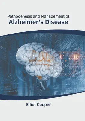 Patogénesis y tratamiento de la enfermedad de Alzheimer - Pathogenesis and Management of Alzheimer's Disease
