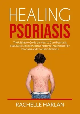 Curación de la Psoriasis: La guía definitiva sobre cómo curar la psoriasis naturalmente, Descubra todos los tratamientos naturales para la psoriasis y la psoriasis. - Healing Psoriasis: The Ultimate Guide on How to Cure Psoriasis Naturally, Discover All the Natural Treatments For Psoriasis and Psoriatic