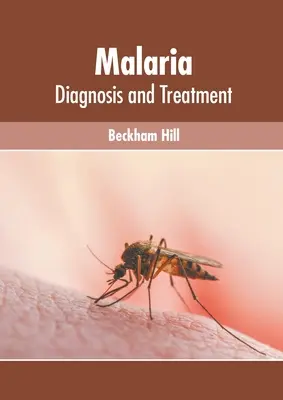 Paludismo: diagnóstico y tratamiento - Malaria: Diagnosis and Treatment
