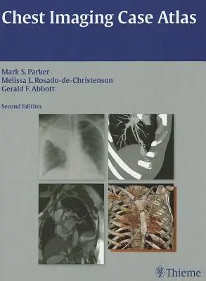 Atlas de casos de imagen torácica - Chest Imaging Case Atlas