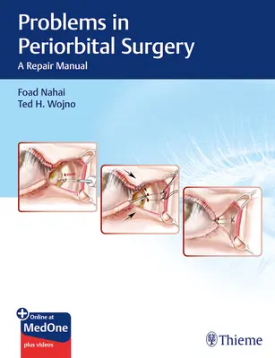 Problemas de cirugía periorbitaria: A Repair Manual - Problems in Periorbital Surgery: A Repair Manual