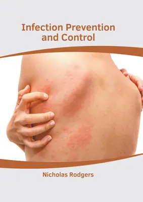 Prevención y control de infecciones - Infection Prevention and Control