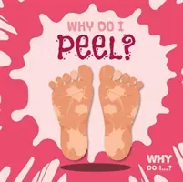 ¿Por qué me peleo? - Why Do I Peel?