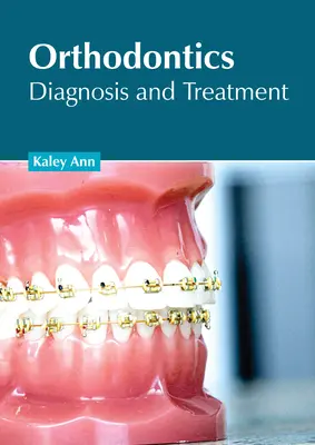 Ortodoncia: Diagnóstico y tratamiento - Orthodontics: Diagnosis and Treatment