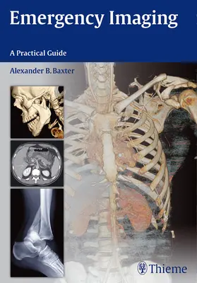 Imágenes de emergencia - Emergency Imaging