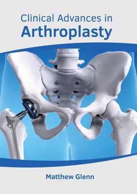 Avances clínicos en artroplastia - Clinical Advances in Arthroplasty