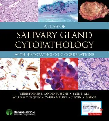 Atlas de Citopatología de las Glándulas Salivares: Con correlaciones histopatológicas - Atlas of Salivary Gland Cytopathology: With Histopathologic Correlations