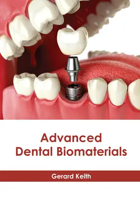 Biomateriales dentales avanzados - Advanced Dental Biomaterials