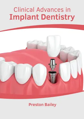 Avances clínicos en implantología - Clinical Advances in Implant Dentistry