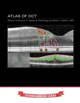 Atlas de OCT: Anatomía retiniana en salud y patología - Atlas of OCT: Retinal Anatomy in Health & Pathology