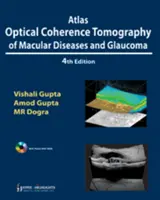 Atlas de tomografía de coherencia óptica de enfermedades maculares y glaucoma - Atlas Optical Coherence Tomography of Macular Diseases and Glaucoma