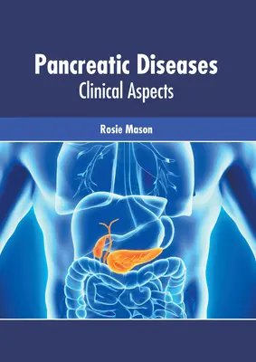 Enfermedades Pancreáticas: Aspectos clínicos - Pancreatic Diseases: Clinical Aspects