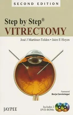 Paso a Paso: Vitrectomía [Con 2 Dvdroms] - Step by Step: Vitrectomy [With 2 Dvdroms]