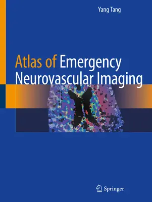 Atlas de imagen neurovascular de urgencia - Atlas of Emergency Neurovascular Imaging