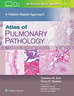 Atlas de Patología Pulmonar: Un enfoque basado en patrones - Atlas of Pulmonary Pathology: A Pattern Based Approach
