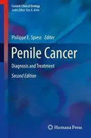 Cáncer de pene: Diagnóstico y Tratamiento - Penile Cancer: Diagnosis and Treatment