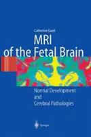 Resonancia magnética del cerebro fetal: Desarrollo normal y patologías cerebrales - MRI of the Fetal Brain: Normal Development and Cerebral Pathologies