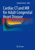 TC y RM cardíacas para cardiopatías congénitas del adulto - Cardiac CT and MR for Adult Congenital Heart Disease