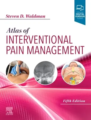 Atlas del tratamiento intervencionista del dolor - Atlas of Interventional Pain Management