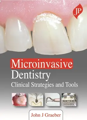 Odontología microinvasiva: estrategias y herramientas clínicas - Microinvasive Dentistry - Clinical Strategies and Tools