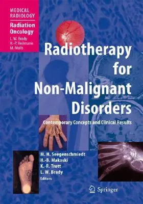 Radioterapia para enfermedades no malignas - Radiotherapy for Non-Malignant Disorders