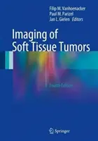 Imágenes de tumores de tejidos blandos - Imaging of Soft Tissue Tumors