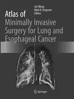 Atlas de cirugía mínimamente invasiva del cáncer de pulmón y esófago - Atlas of Minimally Invasive Surgery for Lung and Esophageal Cancer