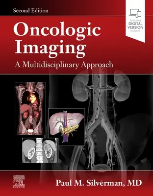 Oncologic Imaging: Un enfoque multidisciplinar - Oncologic Imaging: A Multidisciplinary Approach