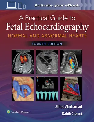Guía práctica de ecocardiografía fetal: Corazones Normales y Anormales - A Practical Guide to Fetal Echocardiography: Normal and Abnormal Hearts