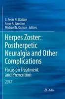 Herpes Zóster: Neuralgia postherpética y otras complicaciones: Enfoque en el tratamiento y la prevención - Herpes Zoster: Postherpetic Neuralgia and Other Complications: Focus on Treatment and Prevention