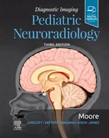 Diagnóstico por imagen: Neurorradiología Pediátrica - Diagnostic Imaging: Pediatric Neuroradiology