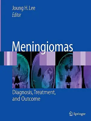 Meningiomas: Diagnóstico, tratamiento y evolución - Meningiomas: Diagnosis, Treatment, and Outcome