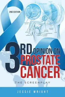 Tercera opinión sobre el cáncer de próstata: El guión - 3rd Opinion on Prostate Cancer: The Screenplay