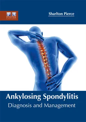 Espondilitis Anquilosante: Diagnóstico y tratamiento - Ankylosing Spondylitis: Diagnosis and Management