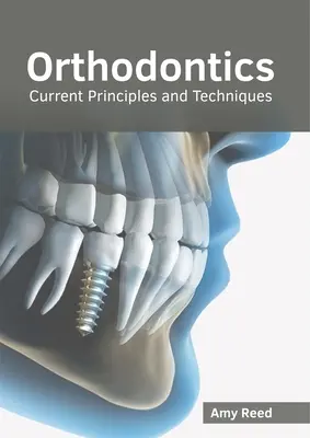 Ortodoncia: Principios y técnicas actuales - Orthodontics: Current Principles and Techniques