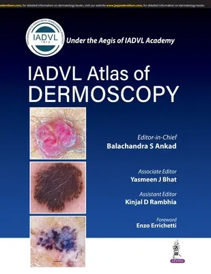 Atlas de Dermatoscopia - Atlas of Dermoscopy