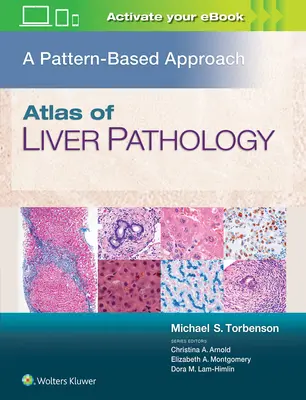 Atlas de patología hepática: Un enfoque basado en patrones - Atlas of Liver Pathology: A Pattern-Based Approach