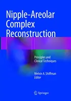 Reconstrucción del complejo areola-pezón: Principios y técnicas clínicas - Nipple-Areolar Complex Reconstruction: Principles and Clinical Techniques