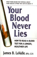 Su sangre nunca miente: Cómo leer un análisis de sangre para tener una vida más larga y saludable - Your Blood Never Lies: How to Read a Blood Test for a Longer, Healthier Life