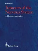 Tumores del sistema nervioso: Atlas ultraestructural - Tumours of the Nervous System: An Ultrastructural Atlas