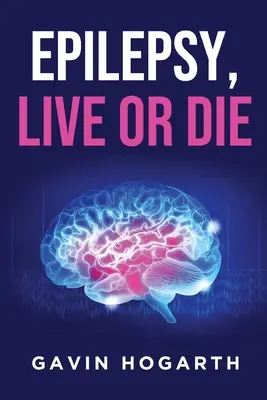 Epilepsia: Vivir o morir - Epilepsy: Live or Die