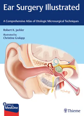 Cirugía de Oído Ilustrada: Atlas exhaustivo de técnicas microquirúrgicas otológicas - Ear Surgery Illustrated: A Comprehensive Atlas of Otologic Microsurgical Techniques