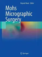 Cirugía micrográfica de Mohs - Mohs Micrographic Surgery