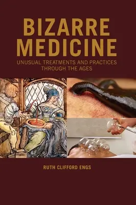 Medicina Bizarra: Tratamientos y prácticas inusuales a través de los tiempos - Bizarre Medicine: Unusual Treatments and Practices through the Ages