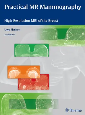 Mamografía por RM Práctica: Resonancia magnética de alta resolución de la mama - Practical MR Mammography: High-Resolution MRI of the Breast