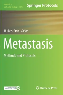 Metástasis: Métodos y Protocolos - Metastasis: Methods and Protocols