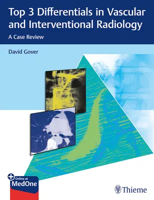 Top 3 Differentials in Vascular and Interventional Radiology: Una revisión de casos - Top 3 Differentials in Vascular and Interventional Radiology: A Case Review